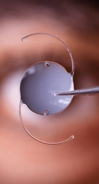 lente-intraocular-em-salvador